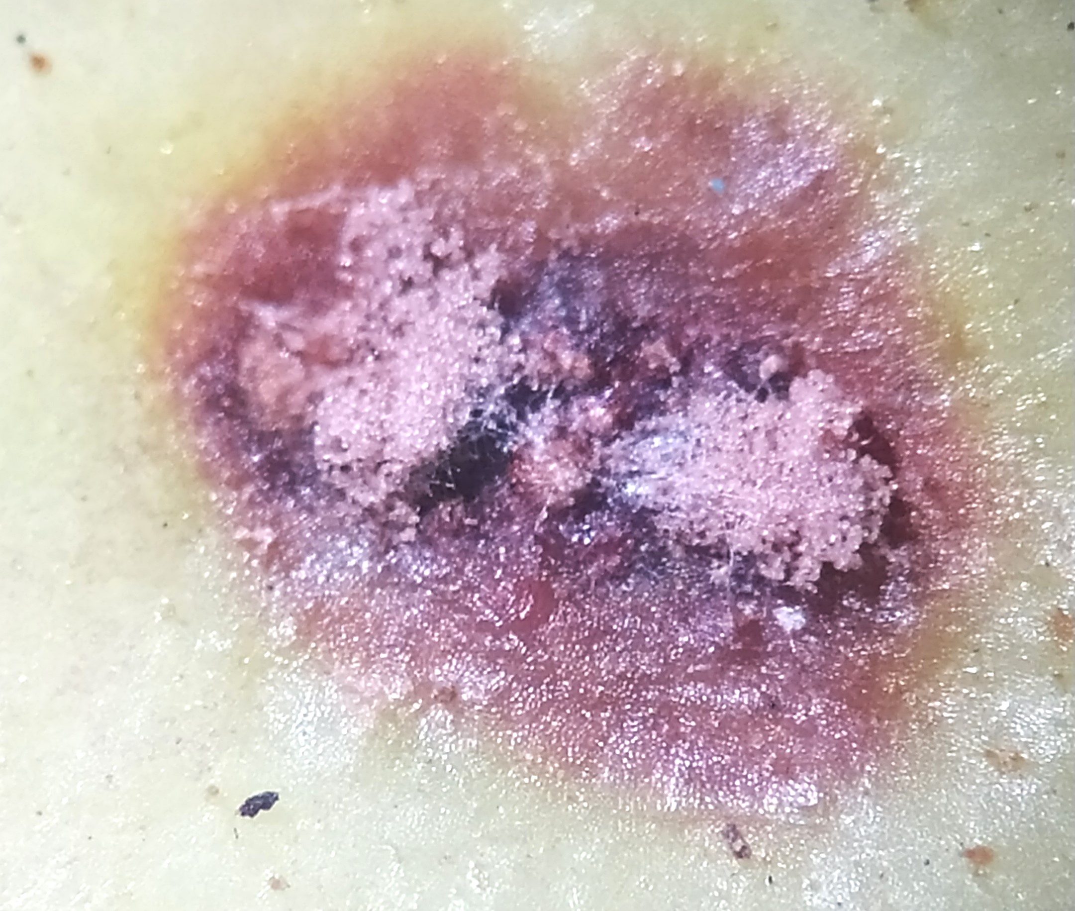 <p><b>Pústulas de ferrugem em fruto de figueira.</b></p><p>Autor: Ricardo José Domingues</p>